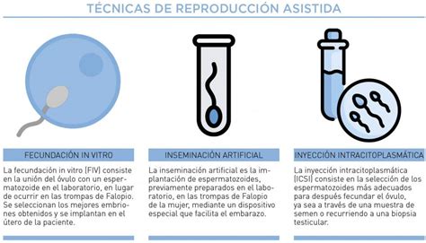 Esquema general de las técnicas de reproducción asistida