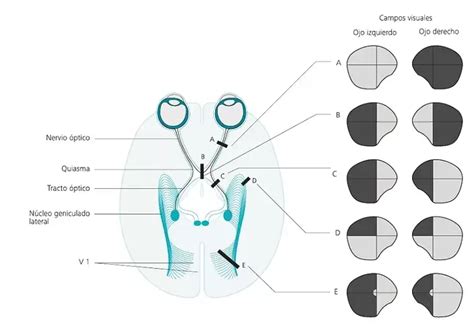 Diagrama de una sección coronal simplificada a través de la formación hipocámpica