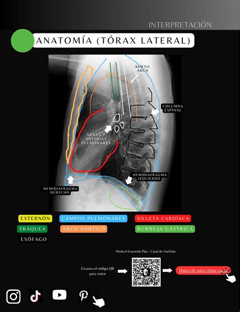 Radiografía de tórax PA y lateral de un lactante