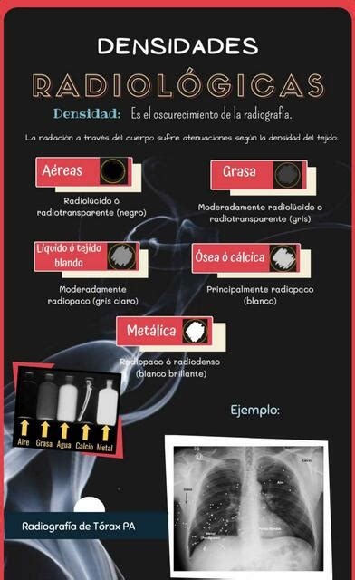 Infografía de densidades radiológicas en el parénquima pulmonar