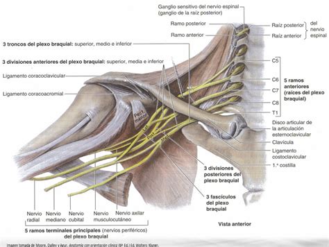 Esquema anatómico del plexo braquial y las posibles zonas de lesión en la parálisis braquial obstétrica
