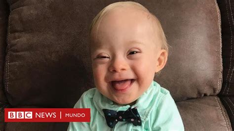 Foto de Lucas Warren, el bebé embajador de Gerber con Síndrome de Down, sonriendo