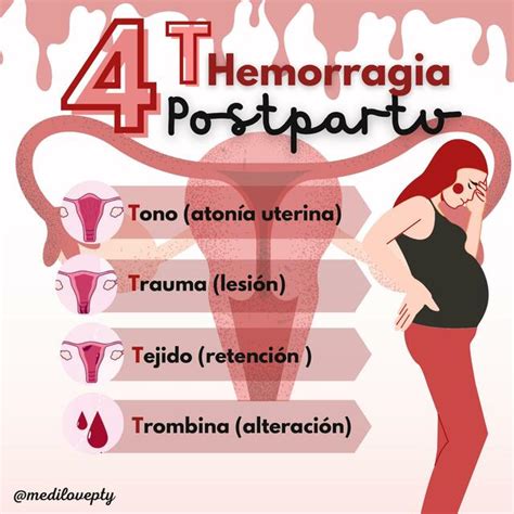 Esquema de las vías que conducen al parto prematuro espontáneo (inflamación, sobredistensión uterina, hemorragia, estrés)