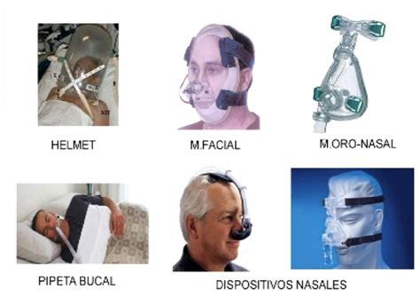 Ilustración de las diferentes interfaces nasales utilizadas en la ventilación no invasiva para neonatos (cánulas, mascarillas, gafas nasales).