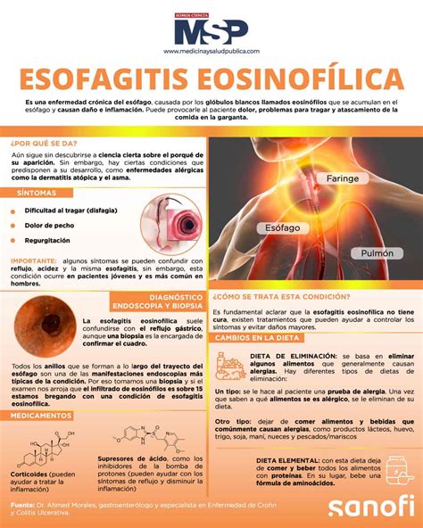 Infografía: síntomas de la esofagitis eosinofílica por edad