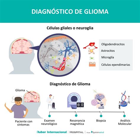 Diagrama mostrando la clasificación de gliomas y glioblastoma
