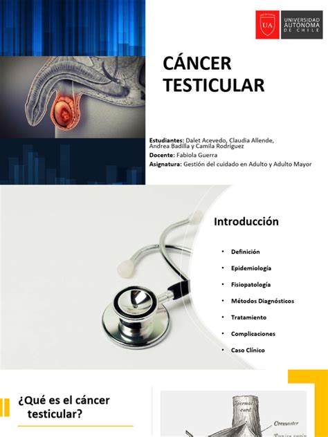 Diagrama de flujo de diagnóstico de cáncer testicular que incluye marcadores tumorales