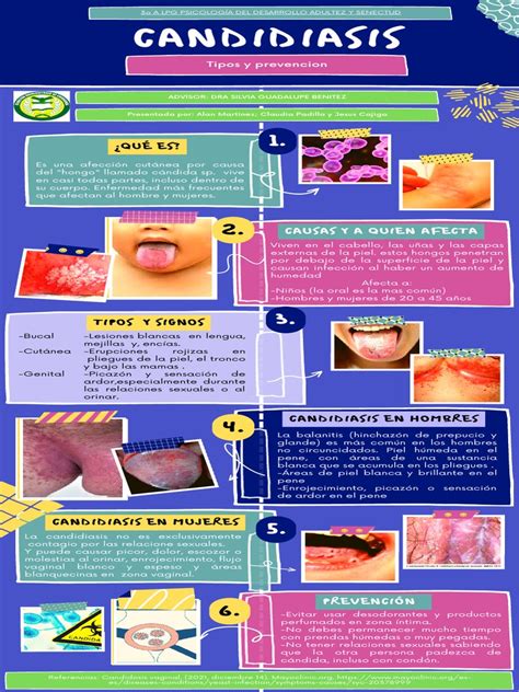 Infografía comparativa de síntomas de candidiasis en hombres y mujeres.