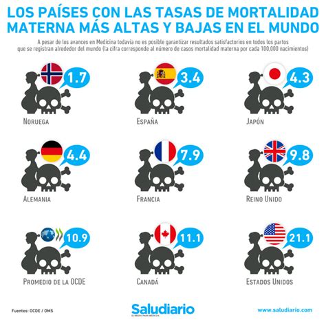 Infografía comparativa de tasas de mortalidad fetal en diferentes regiones del mundo.