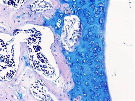Microfotografía de cartílago teñido con azul alcián