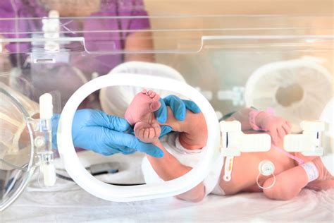 Fotografía de un neonato recibiendo nutrición enteral en una UCIN