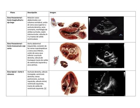 Planos de corte ecocardiográficos en el diagnóstico fetal