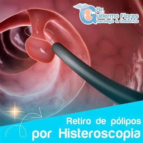 Histeroscopia: visión interna del útero