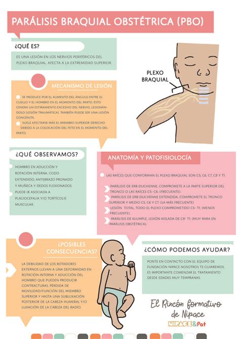 infografía sobre las causas y consecuencias de la parálisis braquial obstétrica