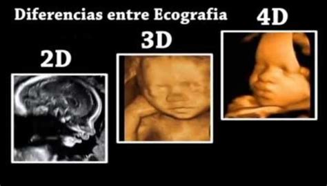 Fotografía de ultrasonido 3D o 4D de un feto en el tercer trimestre de gestación