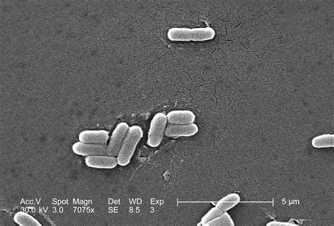 Micrografía electrónica de Escherichia coli