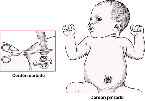 Fotografía: corte y ligadura del cordón umbilical en un cachorro recién nacido