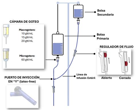 Diagrama: Puntos de acceso para extracción de sangre y administración de fluidos en neonatos