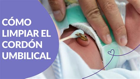 Ilustración técnica sobre la desinfección del muñón umbilical y la importancia de la higiene en el recién nacido.
