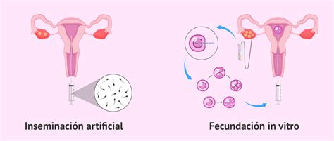 Diagrama de flujo que muestra los diferentes tratamientos de reproducción asistida ofrecidos por Avantia Fertilidad.