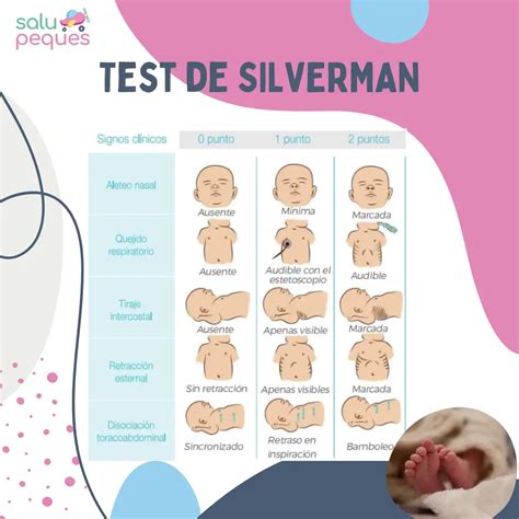 Tabla de la Escala de Silverman