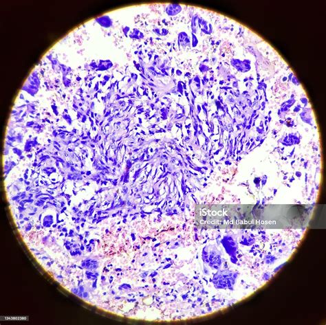 Micrografía de células gigantes binucleares en placenta de rumiante