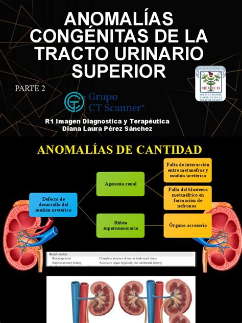 Infografía mostrando diferentes tipos de anomalías congénitas del tracto urinario en niños.