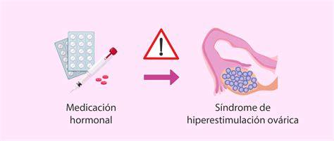 Infografía: Síntomas y severidad del Síndrome de Hiperestimulación Ovárica (SHO)