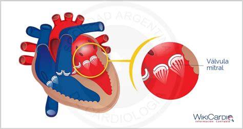 Esquema de la anatomía de la válvula mitral en posición abierta y cerrada