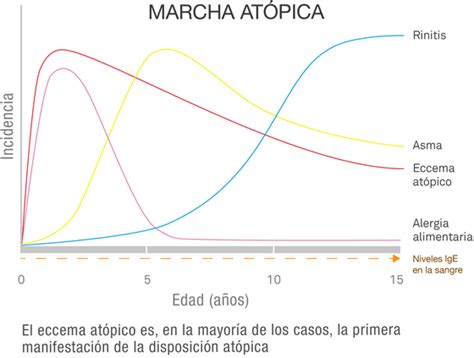 Diagrama de la marcha atópica, mostrando la progresión de la dermatitis atópica a otras alergias.