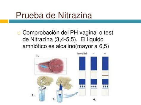 Esquema de la prueba de nitracina y sus resultados