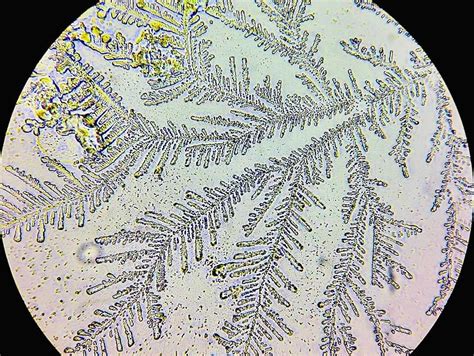 Imagen microscópica del patrón en hojas de helecho del líquido amniótico