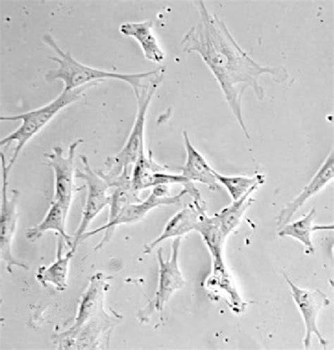 Micrografía de fibroblastos fetales en cultivo