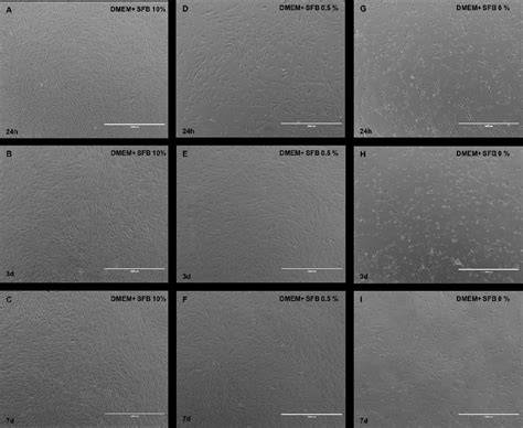 Microfotografías de fibroblastos gingivales en diferentes condiciones de cultivo