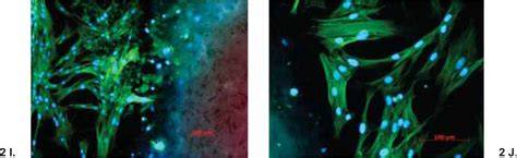 Inmunofluorescencia de actina y mitocondrias en fibroblastos gingivales