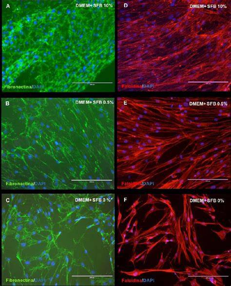Inmunofluorescencia de actina y retículo endoplasmático en fibroblastos gingivales