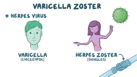 Esquema de la estructura del virus varicela-zóster (VVZ)
