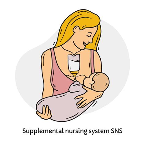 Ilustración de un sistema de nutrición suplementaria (SNS) en uso