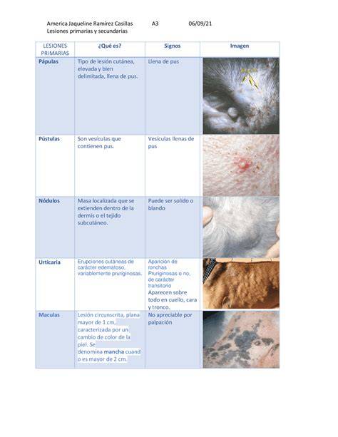 Esquema de las lesiones cutáneas características del mal rojo en cerdos