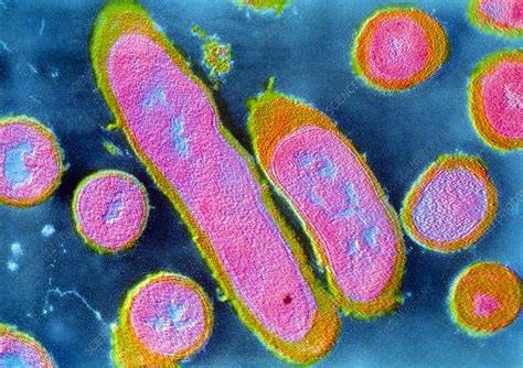 Micrografía de la bacteria Erysipelothrix rhusiopathiae