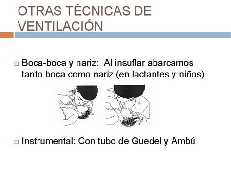 Ilustración de la técnica de ventilación boca a boca y nariz en lactantes