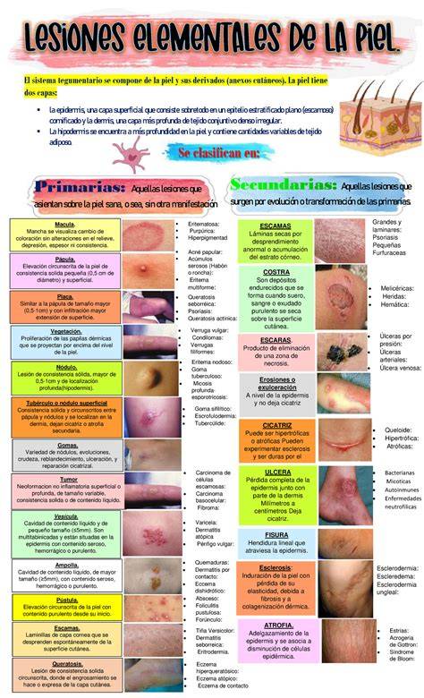 Esquema comparativo de las capas de la piel y los mecanismos inflamatorios en dermatitis atópica frente a seborreica.