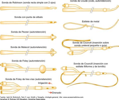 Diagrama ilustrativo de los diferentes tipos de sondas vesicales y sus componentes.