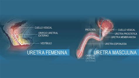Ilustración anatómica que muestra la diferencia entre la uretra masculina y femenina, resaltando las curvas y longitudes.