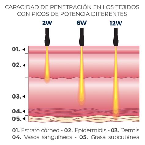 infografía comparativa de la penetración del láser en la piel frente a otras fuentes de calor