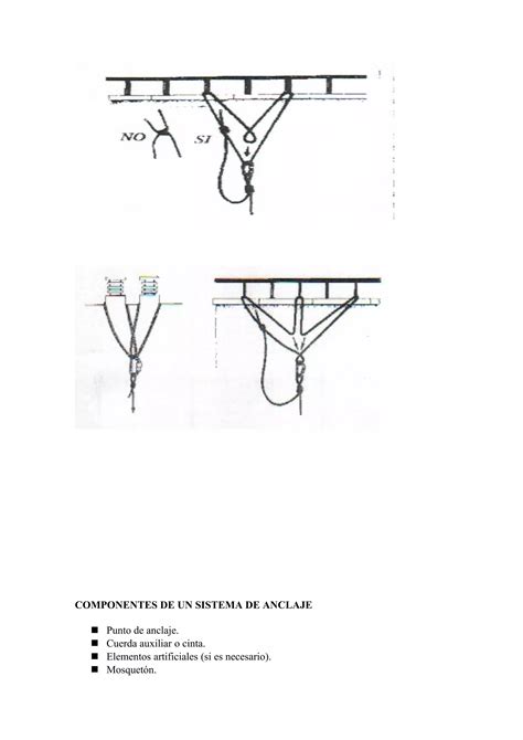 Comparativa visual de diferentes sistemas de anclaje de cunas de colecho.