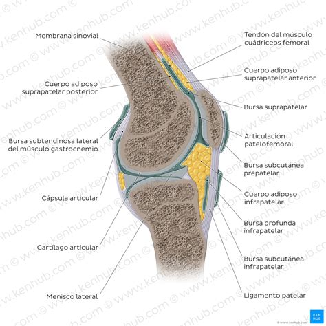 Gráfico explicativo de la anatomía de la rodilla y las estructuras afectadas en una lesión de ligamentos