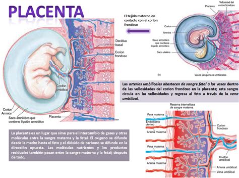 Representación esquemática de la placenta adherida al útero y el inicio de su separación.