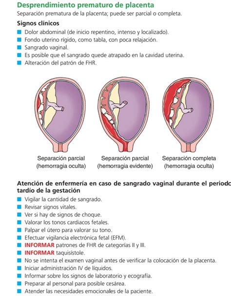 Microfotografía de una sección de placenta mostrando signos de desprendimiento.