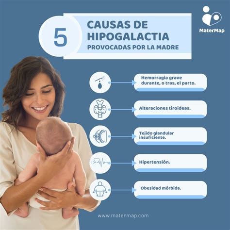 Diagrama que ilustra las posibles causas de hipogalactia, clasificadas por origen (materno, manejo, etc.).